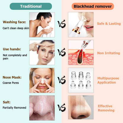 6 in 1 Blackhead Remover